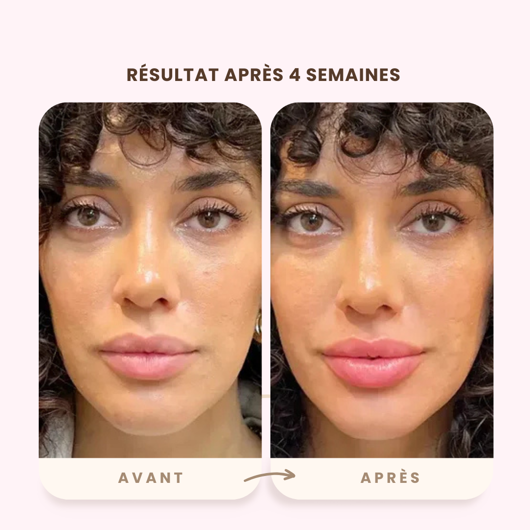 Repulpeur à lèvre